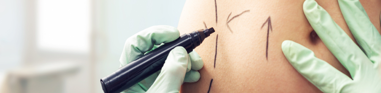 Doctor preparing for cosmetic surgery on patient